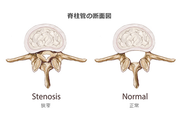 脊椎疾患の診療